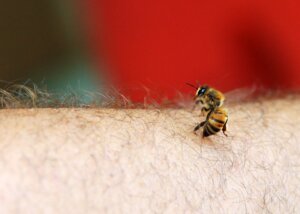  What Essential Oil is Good for Bee Stings